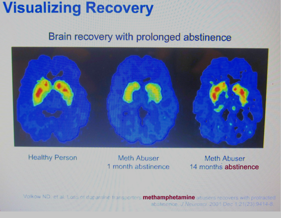 Testosterone levels in men